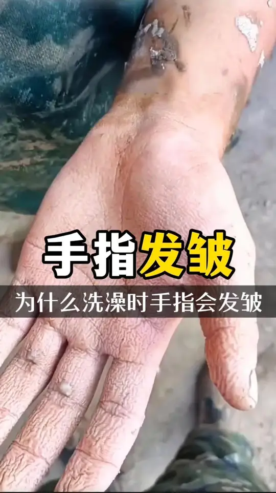 为什么人洗澡时手指会被泡皱