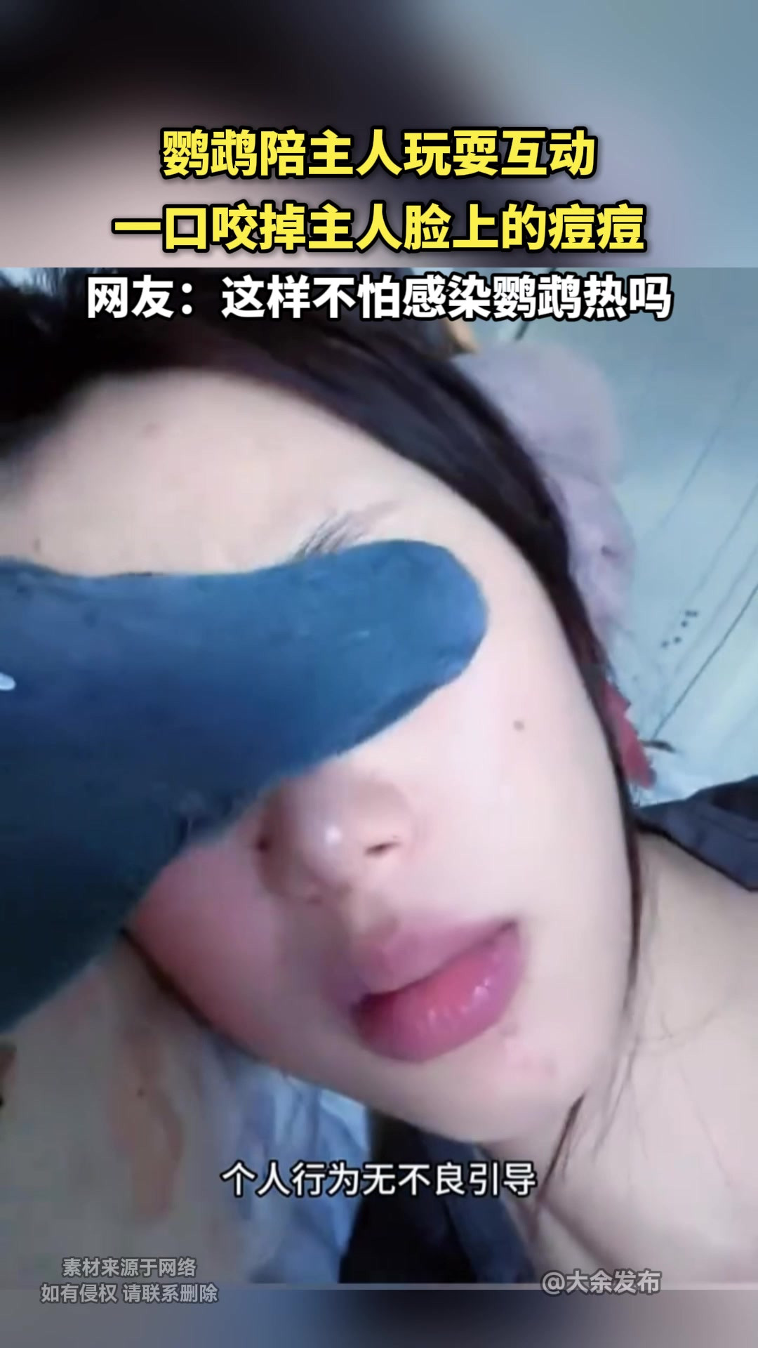 鹦鹉陪主人玩耍互动一口咬掉主人脸上的痘痘