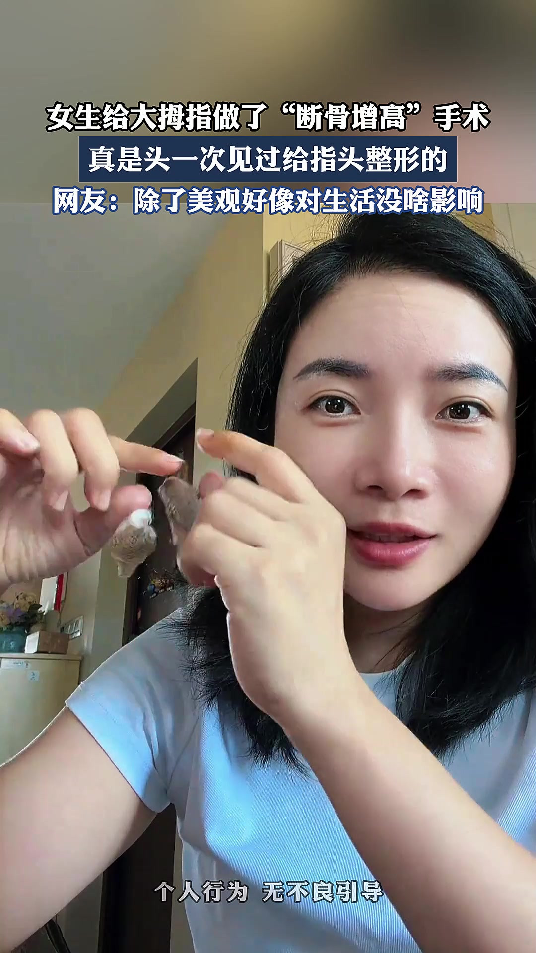 女生给大拇指做了“断骨增高”手术，真是头一次见过给指头整形的。