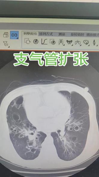 医学影像病例分享