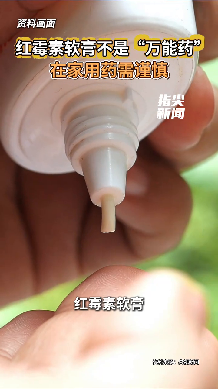 红霉素软膏不是“万能药”在家用药需谨慎