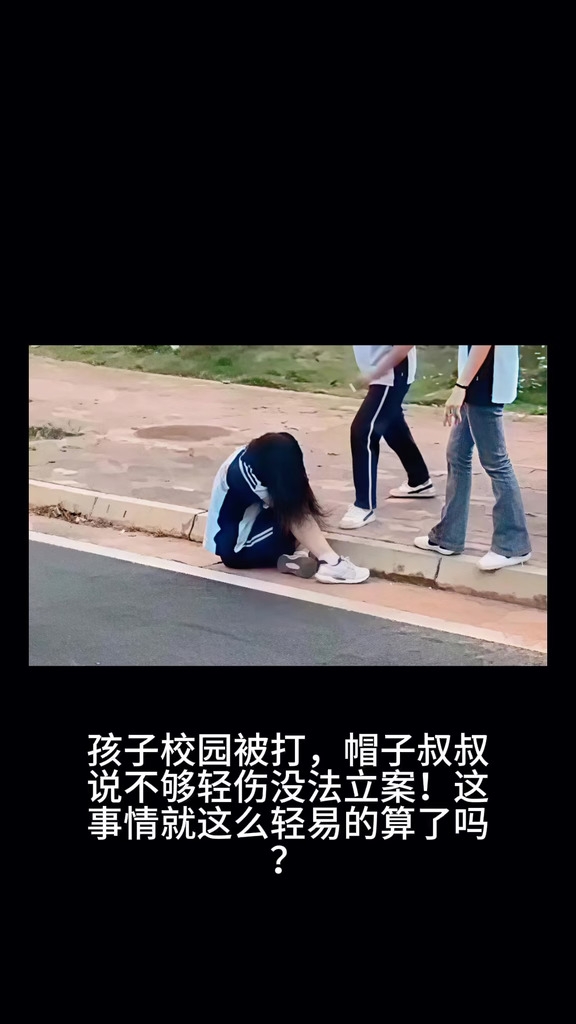 孩子校园被打，帽子叔叔说不够轻伤没法立案！这事情就这么轻易的算了吗？ #校园霸凌事件  #校园暴力 