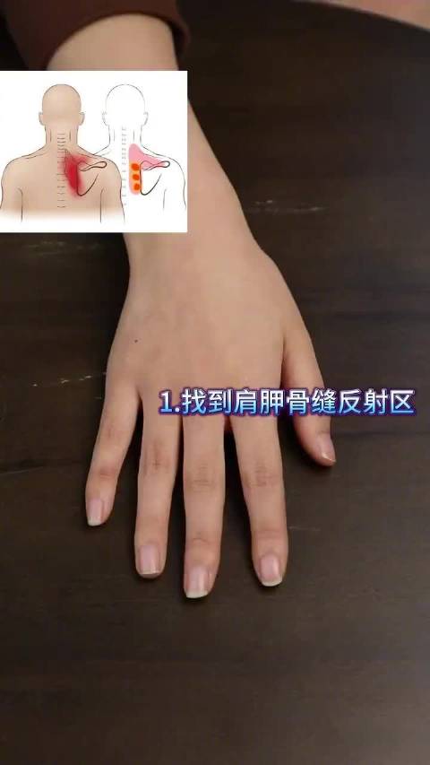 肩胛骨痛的可以尝试揉这里来缓解