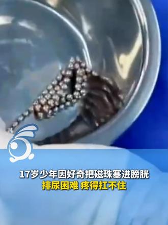 17岁少年因好奇把磁珠塞进膀胱 排尿困难 疼得扛不住