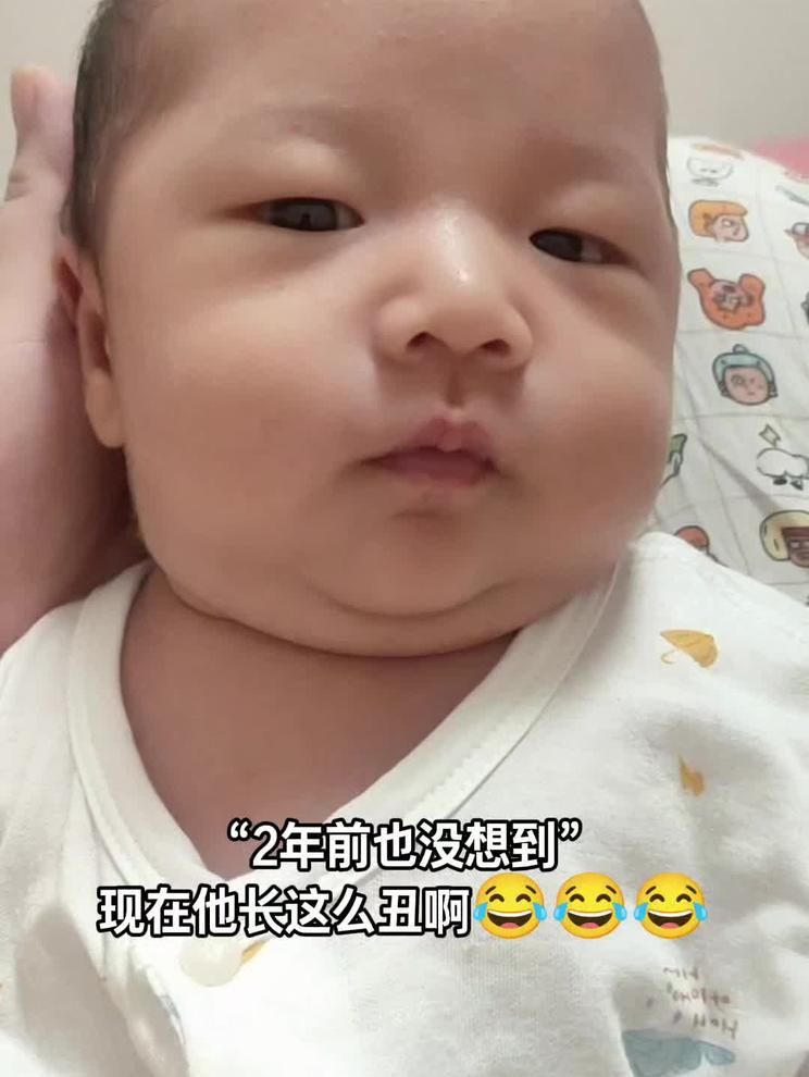 小时候VS长大后 越长越尴尬啊😂😂😂