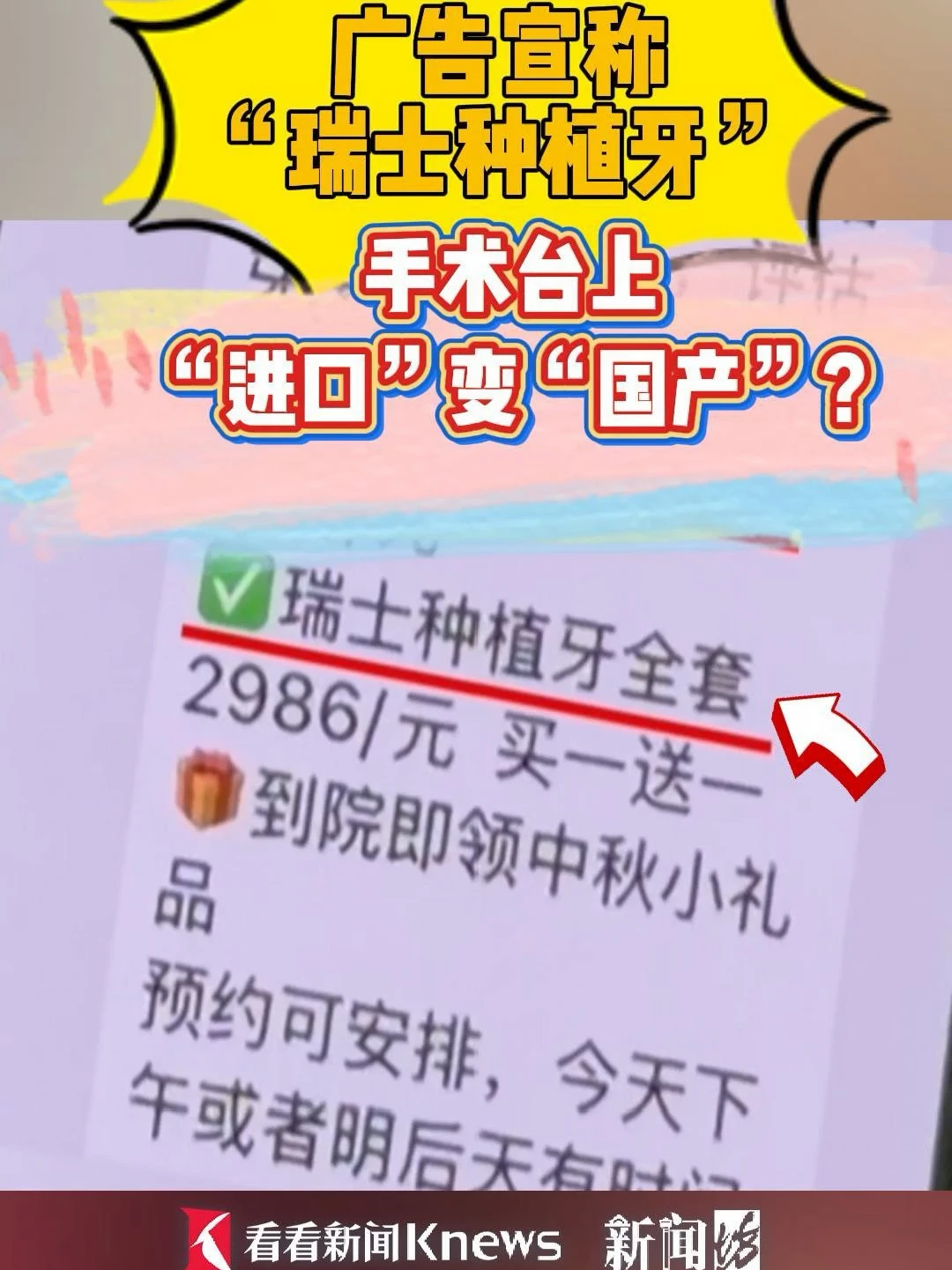 5500种两颗牙，无不适不发炎，但很烧心