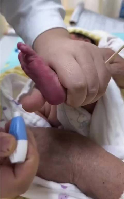 原来新生儿是这么抽血的