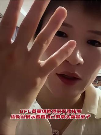 UFC女子草量级世界冠军-中国格斗一姐“马格南”-张伟丽给拳迷粉丝展示自己的拳头，看看拳头都是茧子✊