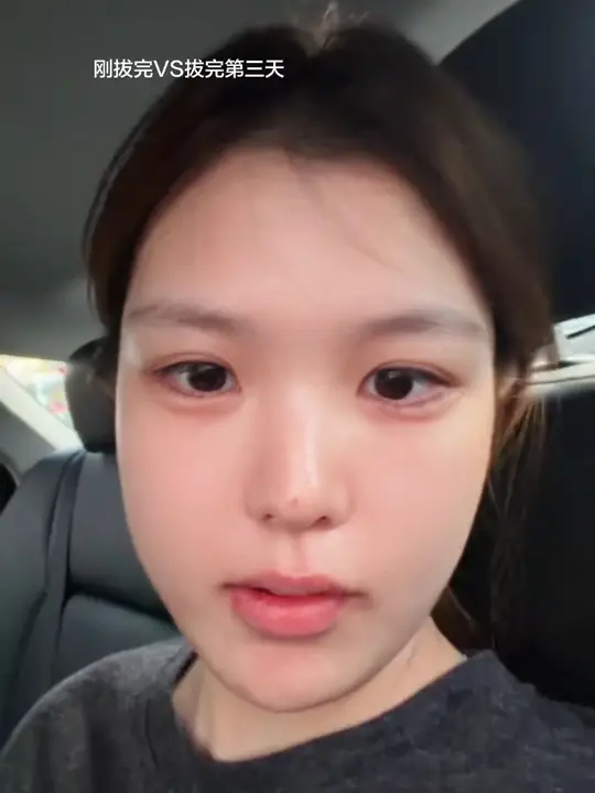 爱人的智齿是世界第八大洲