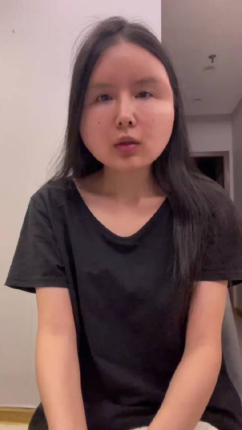 #女子注射生长因子脸疯长成畸形##热点聚焦##科普有答案# 深圳肖女士这个案例真的很触目惊心