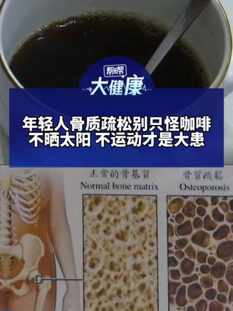 年轻人骨质疏松别只怪咖啡 不晒太阳 不运动才是大患 医生：喝咖啡加奶帮助把钙补回 每天晒15到20分