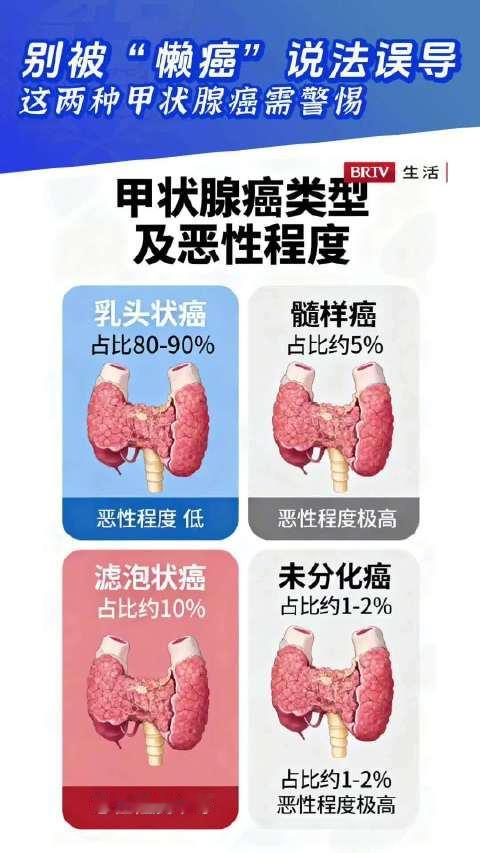 【#别再以为甲状腺癌全是懒癌了#！】#两类甲状腺癌需警惕# BRTV生活频道《全民健康学院》科普：很
