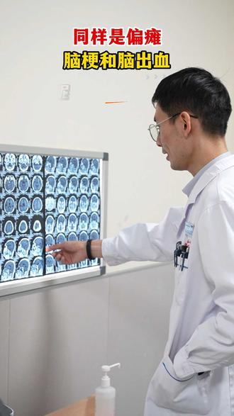 脑梗和脑出血虽统称脑中风后遗症，恢复难度却差很多。病因上，脑梗是血管被血栓堵死、脑组织缺血坏死，像田