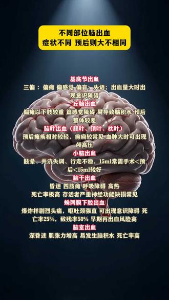 脑出血