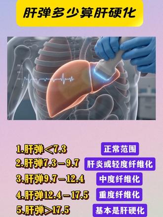 肝弹多少算肝硬化