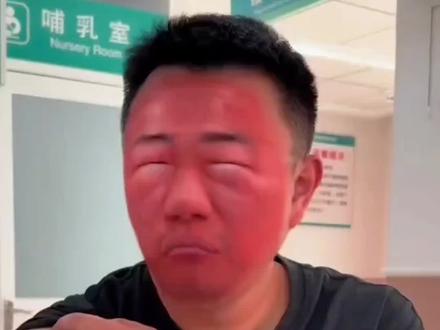 警惕！这种“香椿”千万别吃，有人脸肿到”“亲妈都难认”
