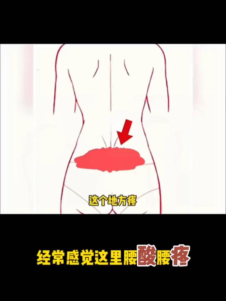 酸腰痛？找准这个部位！