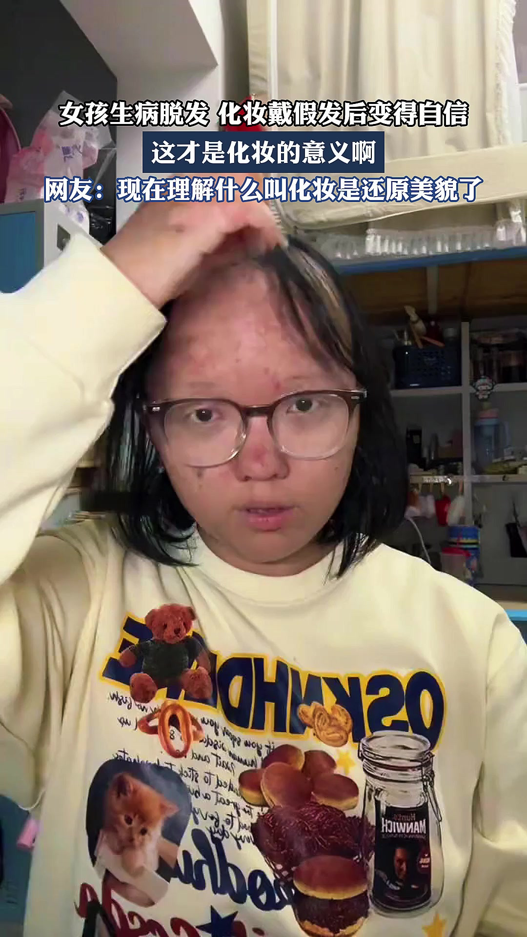 女孩生病脱发，化妆戴假发后变得自信，这才是化妆的意义啊。