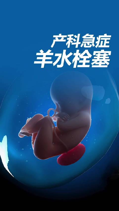 #38岁产妇催产时突发羊水栓塞至今未醒#莆田这位38岁三胎妈妈，催产时遇上羊水栓塞。 明明已经顺利生
