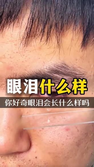 你有没有好奇眼泪究竟长什么样子