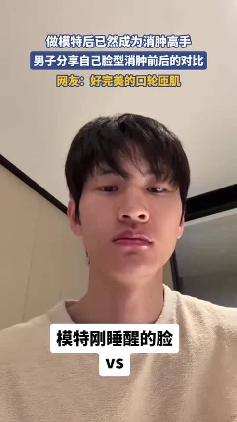 男子分享消肿前后对比照，网友：完美口轮匝肌