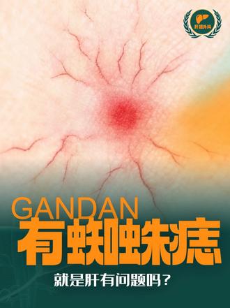 身上有蜘蛛痣，是肝出现问题了吗？