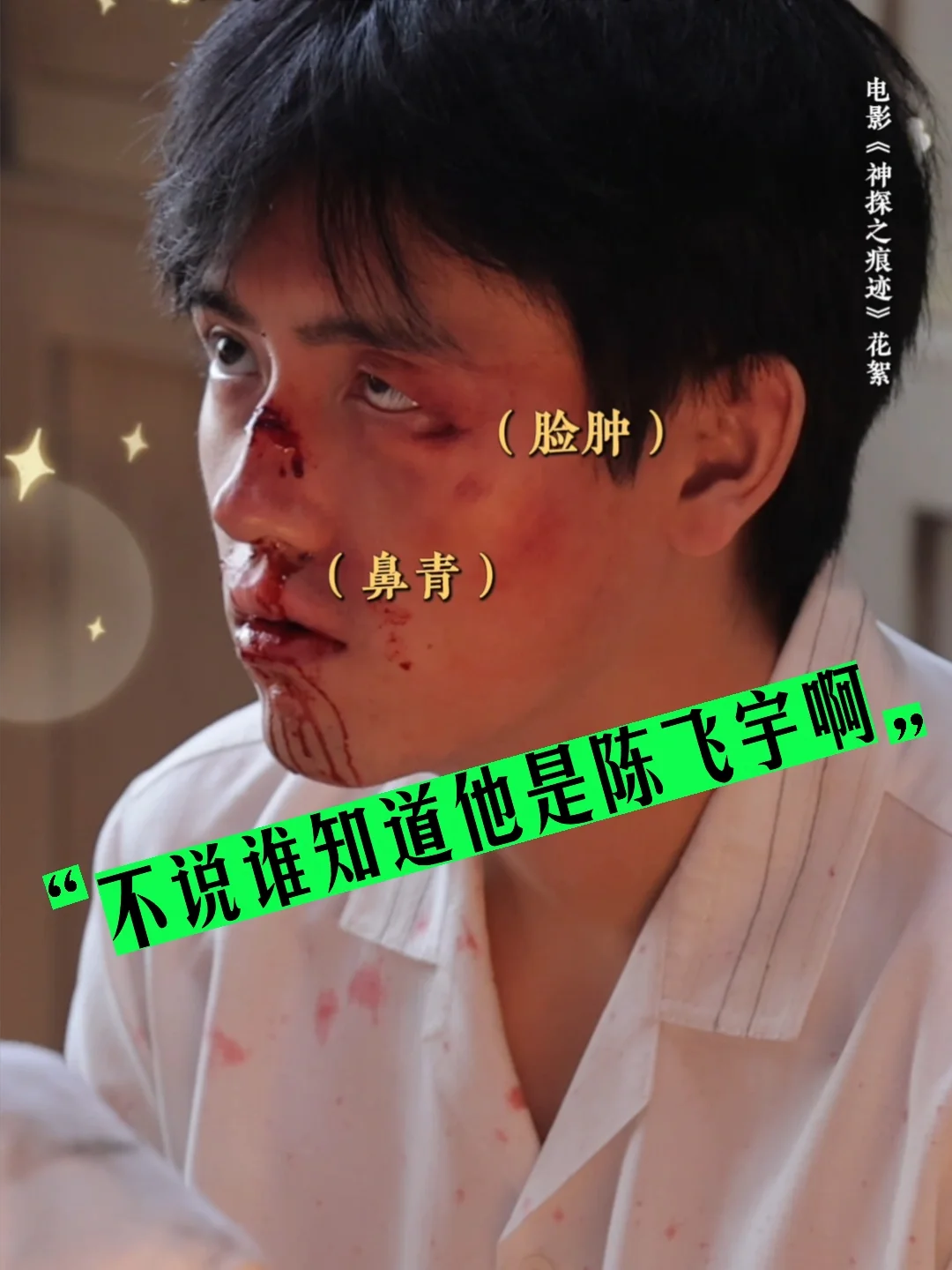 马丽开始没有认出来鼻青脸肿的陈飞宇