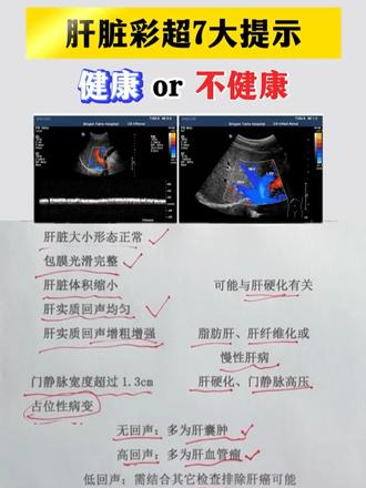 肝脏彩超