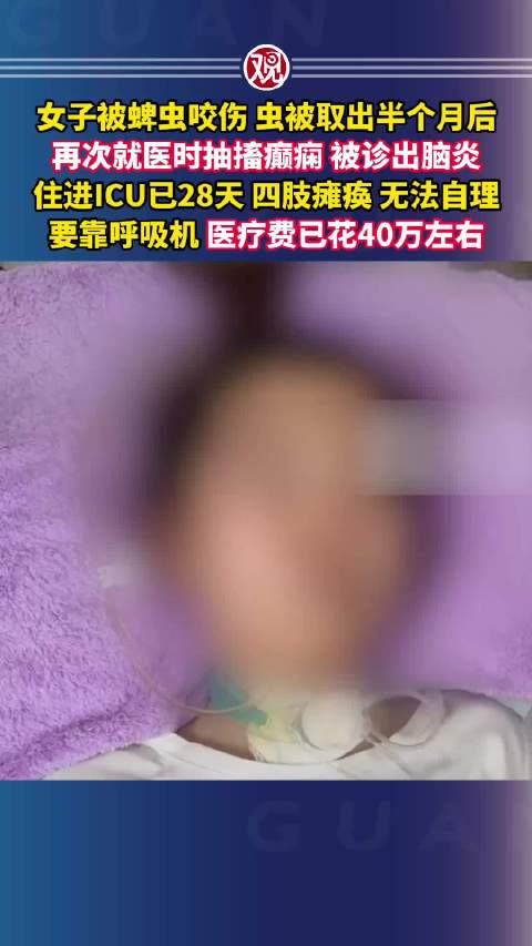 #女子被蜱虫咬伤诱发森林脑炎进ICU#女子被蜱虫咬伤，虫被取出半个月后，再次就医时抽搐癫痫，被诊出脑