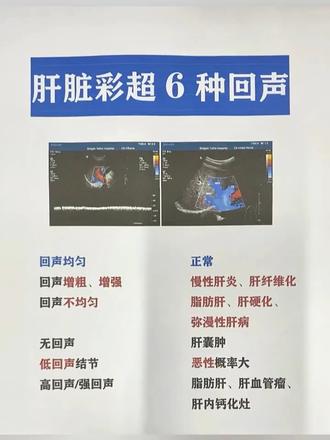 肝脏彩超6种回声分别代表什么